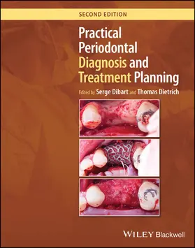 Dibart / Dietrich |  Practical Periodontal Diagnosis and Treatment Planning | Buch |  Sack Fachmedien