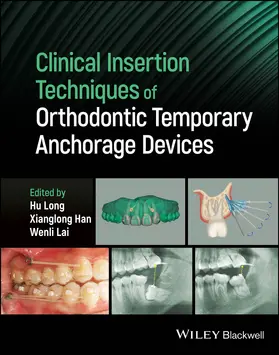 Long / Han / Lai |  Clinical Insertion Techniques of Orthodontic Temporary Anchorage Devices | Buch |  Sack Fachmedien