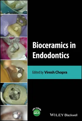 Chopra | Bioceramics in Endodontics | Buch | 978-1-119-89844-3 | sack.de