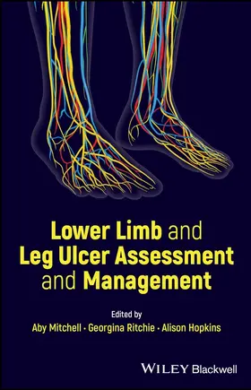 Mitchell / Ritchie / Hopkins |  Lower Limb and Leg Ulcer Assessment and Management | Buch |  Sack Fachmedien