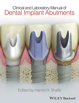 Shafie |  Clinical and Laboratory Manual of Dental Implant Abutments | Buch |  Sack Fachmedien