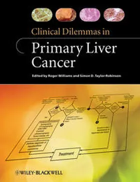 Williams / Taylor-Robinson |  Clinical Dilemmas in Primary Liver Cancer | eBook | Sack Fachmedien
