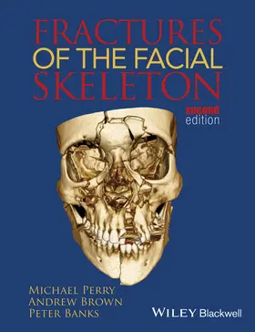Perry / Brown / Banks |  Fractures of the Facial Skeleton | Buch |  Sack Fachmedien
