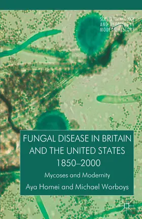 Homei / Worboys |  Fungal Disease in Britain and the United States 1850-2000 | Buch |  Sack Fachmedien