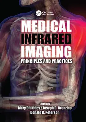 Diakides / Bronzino / Peterson |  Medical Infrared Imaging | Buch |  Sack Fachmedien
