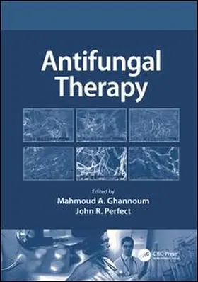 Ghannoum / Perfect, MD | Antifungal Therapy | Buch | 978-1-138-11428-9 | www2.sack.de