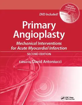 Antoniucci | Primary Angioplasty | Buch | 978-1-138-11465-4 | sack.de