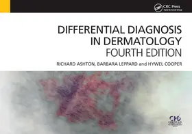 Ashton / Leppard |  Differential Diagnosis in Dermatology | Buch |  Sack Fachmedien