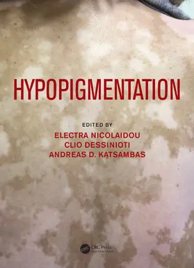Nicolaidou / Dessinioti / Katsambas | Hypopigmentation | Buch | 978-1-138-50523-0 | sack.de
