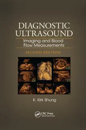 Shung | Diagnostic Ultrasound | Buch | 978-1-138-89288-0 | sack.de