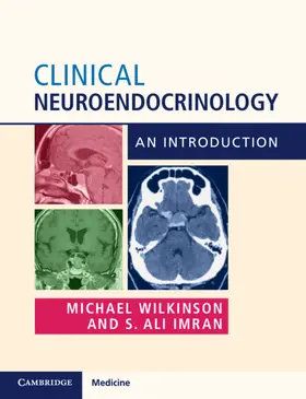 Wilkinson / Imran | Clinical Neuroendocrinology | Buch | 978-1-316-64519-2 | sack.de