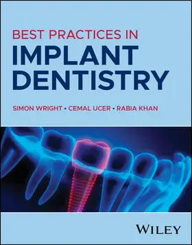 Ucer / Wright / Khan | Best Practices in Implant Dentistry | Buch | 978-1-394-19964-8 | sack.de