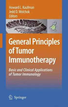 Wolchok / Kaufman |  General Principles of Tumor Immunotherapy | Buch |  Sack Fachmedien