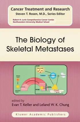 Chung / Keller |  The Biology of Skeletal Metastases | Buch |  Sack Fachmedien