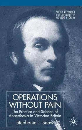 Snow |  Operations Without Pain: The Practice and Science of Anaesthesia in Victorian Britain | Buch |  Sack Fachmedien