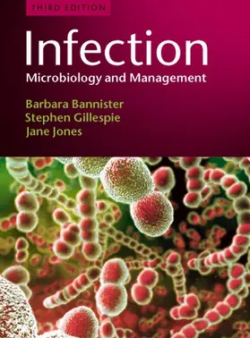 Bannister / Gillespie / Jones |  Infection | Buch |  Sack Fachmedien