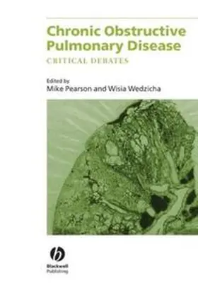 Pearson / Wedzicha |  Chronic Obstructive Pulmonary Disease | eBook | Sack Fachmedien