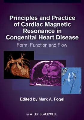 Fogel |  Principles and Practice of Cardiac Magnetic Resonance in Congenital Heart Disease: Form, Function, and Flow | Buch |  Sack Fachmedien