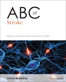 Mant / Walker | ABC of Stroke | Buch | 978-1-4051-6790-1 | sack.de