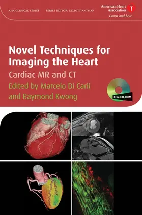 Di Carli / Kwong |  Novel Techniques for Imaging the Heart | Buch |  Sack Fachmedien