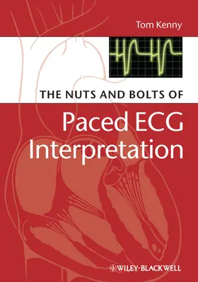 Kenny |  The Nuts and Bolts of Paced ECG Interpretation | Buch |  Sack Fachmedien