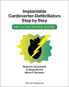 Stroobandt / Barold / Sinnaeve |  Implantable Cardioverter - Defibrillators Step by Step | Buch |  Sack Fachmedien