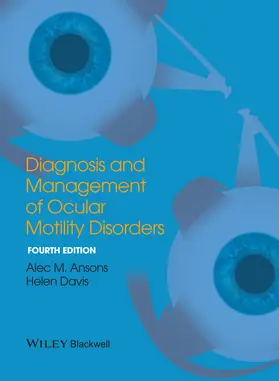 Ansons / Davis |  Diagnosis and Management of Ocular Motility Disorders | Buch |  Sack Fachmedien
