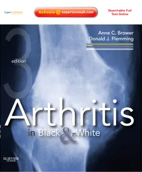 Brower / Flemming |  Arthritis in Black & White | Buch |  Sack Fachmedien