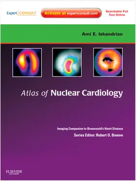 Iskandrian / Garcia |  Atlas of Nuclear Cardiology: Imaging Companion to Braunwald's Heart Disease | Buch |  Sack Fachmedien