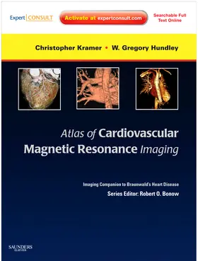 Kramer / Hundley |  Atlas of Cardiovascular Magnetic Resonance Imaging: Expert Consult - Online and Print | Buch |  Sack Fachmedien