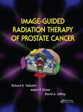 Valicenti / Dicker / Jaffray |  Image-Guided Radiation Therapy of Prostate Cancer | Buch |  Sack Fachmedien