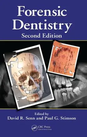 Senn / Stimson | Forensic Dentistry | Buch | 978-1-4200-7836-7 | sack.de