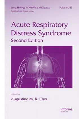 Choi |  Acute Respiratory Distress Syndrome | Buch |  Sack Fachmedien