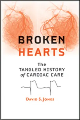 Jones |  Broken Hearts: The Tangled History of Cardiac Care | Buch |  Sack Fachmedien