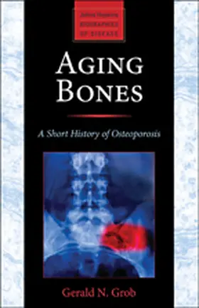 Grob | Aging Bones | Buch | 978-1-4214-1318-1 | www2.sack.de