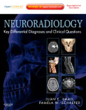 Small / Schaefer |  Neuroradiology | Buch |  Sack Fachmedien