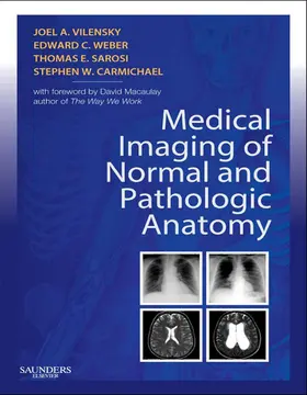 Vilensky / Weber DO / Sarosi MD |  Medical Imaging of Normal and Pathologic Anatomy E-Book | eBook | Sack Fachmedien