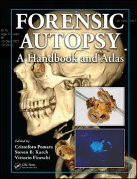 Pomara / Fineschi / Karch | Forensic Autopsy | Buch | 978-1-4398-0064-5 | www2.sack.de