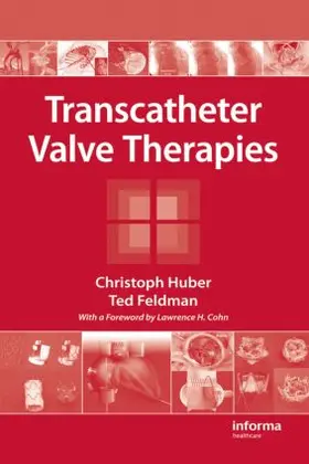 Huber / Feldman |  Transcatheter Valve Therapies | Buch |  Sack Fachmedien