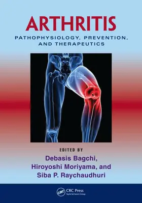 Bagchi / Moriyama / Raychaudhuri |  Arthritis | eBook | Sack Fachmedien