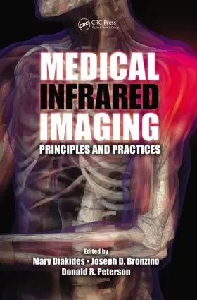 Diakides / Bronzino / Peterson | Medical Infrared Imaging | Buch | 978-1-4398-7249-9 | sack.de