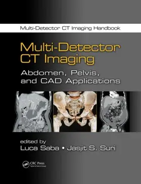 Saba / Suri |  Multi-Detector CT Imaging | Buch |  Sack Fachmedien