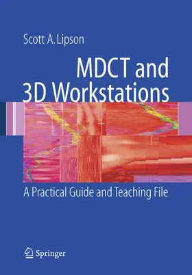 Lipson |  MDCT and 3D Workstations | Buch |  Sack Fachmedien