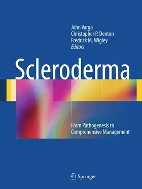 Varga / Denton / Wigley | Scleroderma | E-Book | sack.de