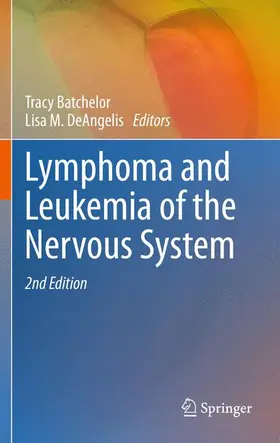 DeAngelis / Batchelor |  Lymphoma and Leukemia of the Nervous System | Buch |  Sack Fachmedien
