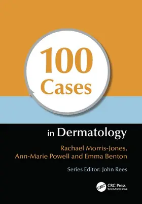 Morris-Jones / Powell / Benton |  100 Cases in Dermatology | Buch |  Sack Fachmedien