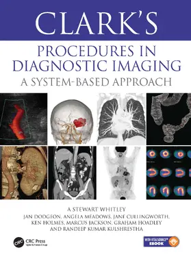 Whitley / Dodgeon / Meadows |  Clark’s Procedures in Diagnostic Imaging | Buch |  Sack Fachmedien