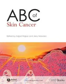 Rajpar / Marsden |  ABC of Skin Cancer | eBook | Sack Fachmedien
