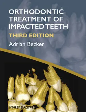 Becker |  Orthodontic Treatment of Impacted Teeth | Buch |  Sack Fachmedien