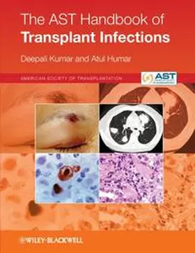 Kumar / Humar |  The AST Handbook of Transplant Infections | eBook | Sack Fachmedien